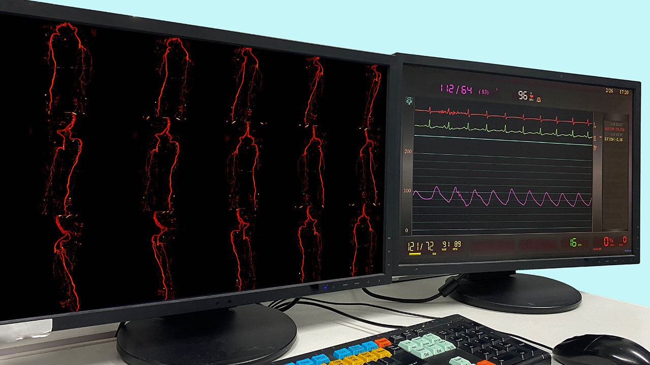 ΤΜΗΜΑ ΑΞΟΝΙΚΗΣ ΑΓΓΕΙΟΓΡΑΦΙΑΣ | Ακτινοδιαγνωστικό Κέντρο Παιανίας | Γεώργιος Γ. Λεβαντής